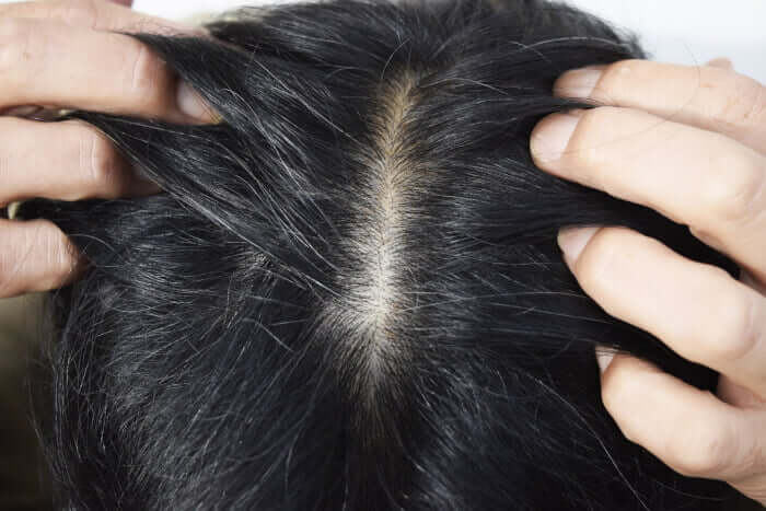 頭皮の臭い・加齢臭に悩む男性・女性のイメージ